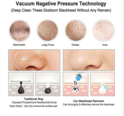 Electric Blackhead Remover Facial Pore Cleaner