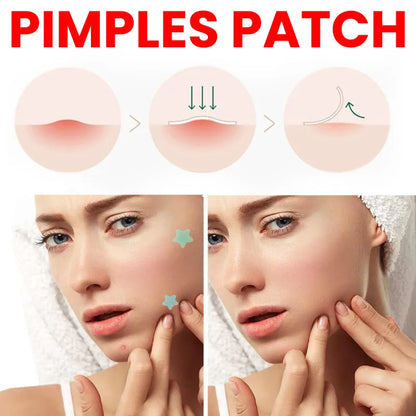 Desalting Pimple Spot Skin Repair Patch
