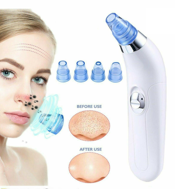 Electric Blackhead Remover Facial Pore Cleaner
